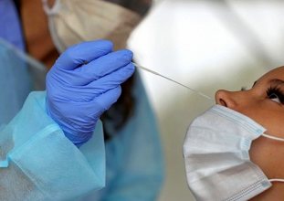 kovid-19 testinden fazla alınan ücretler iade edilecek mi